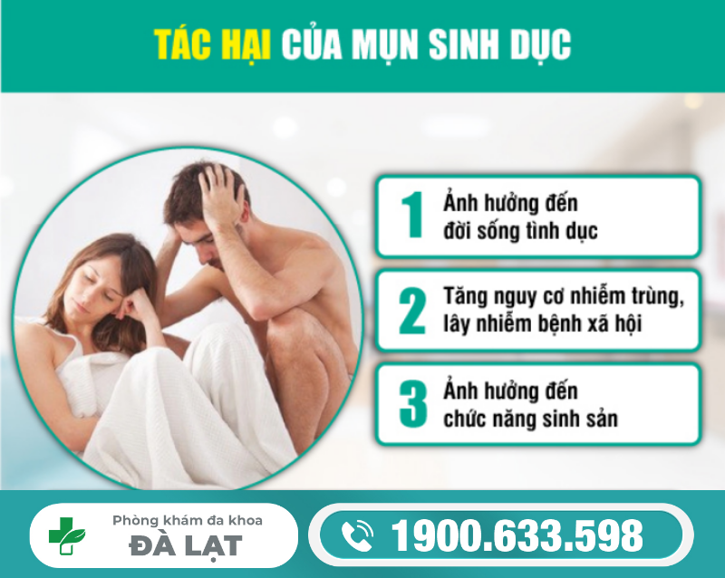 Hình ảnh minh họa